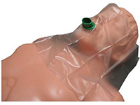Vent Aid Resuscitation Device